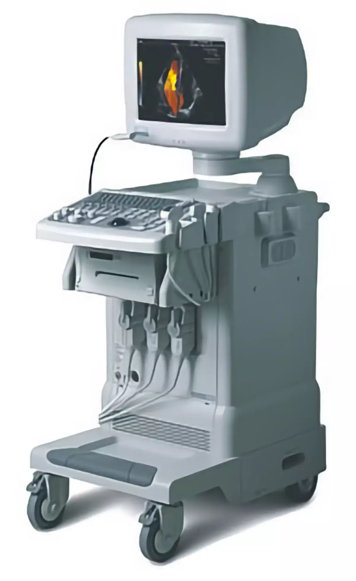 УЗИ сканер SonoAce-8000 Ex (снят с производства)