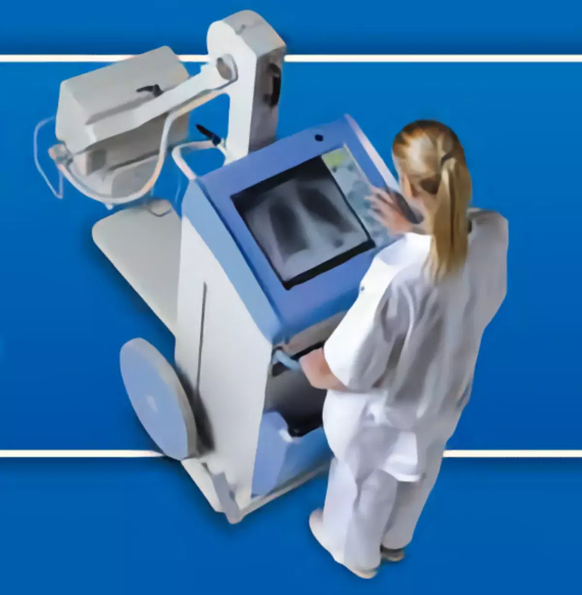 Мобильный рентгенографический аппарат TMS300RDR, 30кВт
